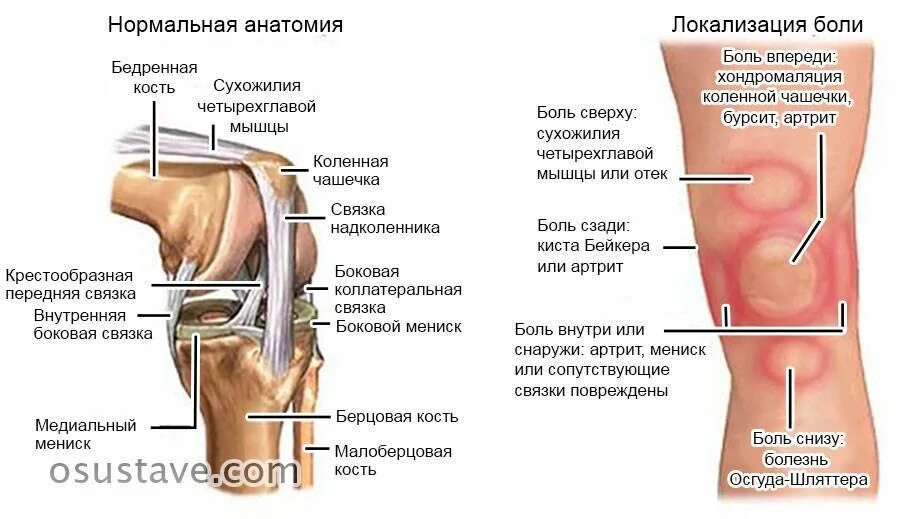 Боль под коленом спереди