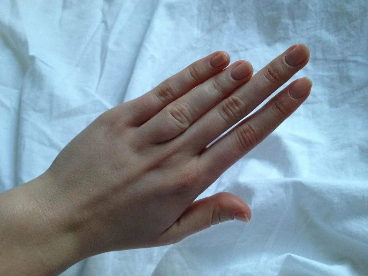 Брахидактилия мизинцев. Длинные пальцы. Женские руки с длинными пальцами. Короткие пальцы у мужчины