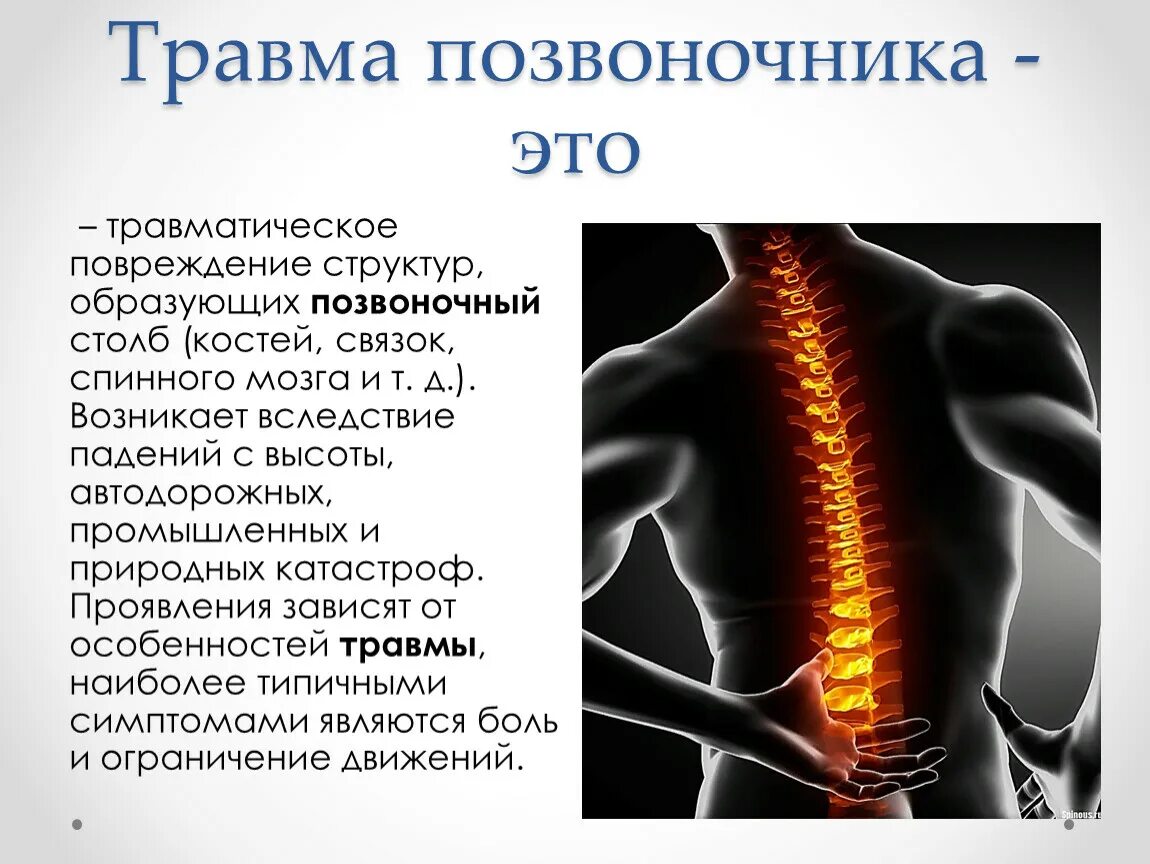 В спине и пояснице можно. Поврежденияпозвоночник. Травма позвоночника, спины. Травмы позвоночника презентация.