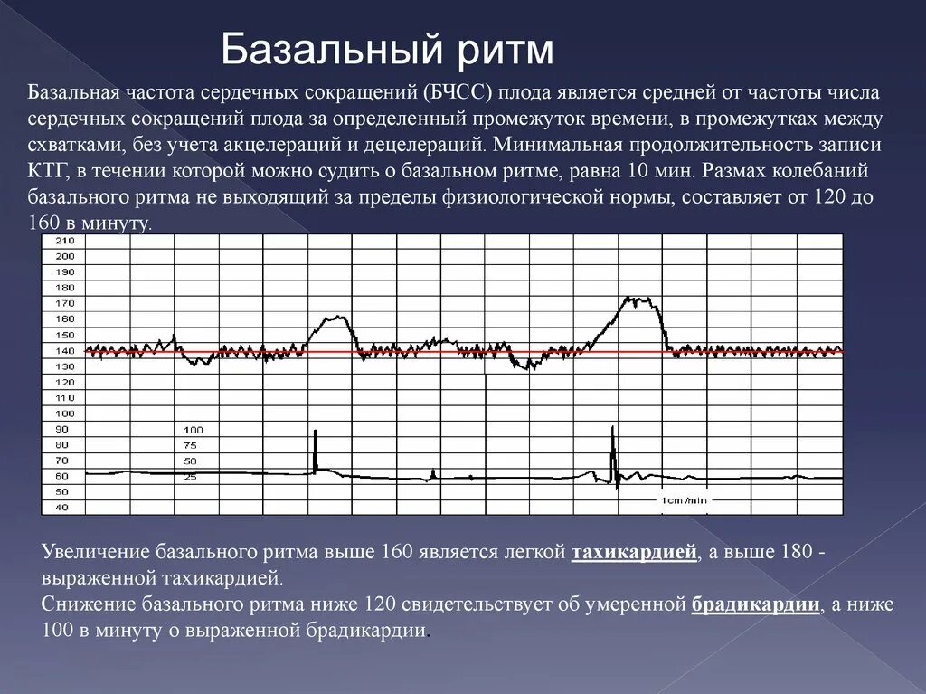 Чч сс. Базальная частота сердечных сокращений плода. Базальный ритм. Кардиотокография плода. Частота сердечных сокращений у плода.