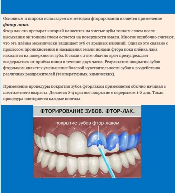 глубокое фторирование зубов. покрытие от кариеса. микроабразия гипоплазия. покрытие от кариеса. покрытие от кариеса.