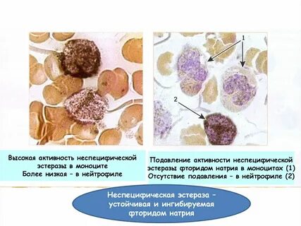 Неспецифическая активность