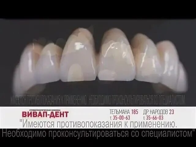 Вивап дент ул тельмана 185 отзывы