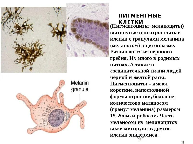 Злокачественные новообразования кожи. Меланоциты эпидермиса кожи. Пигментные клетки гистология. Пигментные клетки кожи головастика препарат гистология. Пигментные клетки строение.