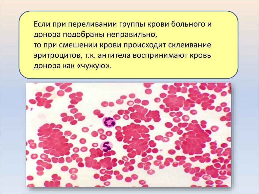 Склеивание крови. Эритроциты переливание крови. Группа крови. Группы крови человека переливание крови.