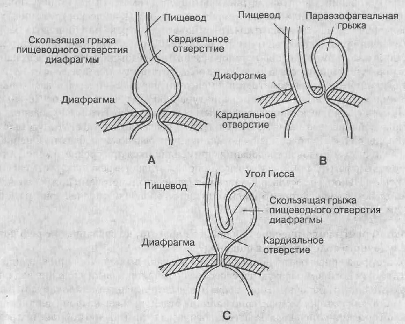 Гпод 1