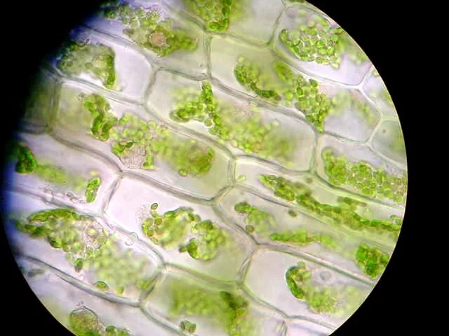 Хлоропласты микроскоп. Хлоропласт в световой микроскоп. Клетка элодеи под микроскопом. Пластиды элодеи. Клетки элодеи в микроскопе.