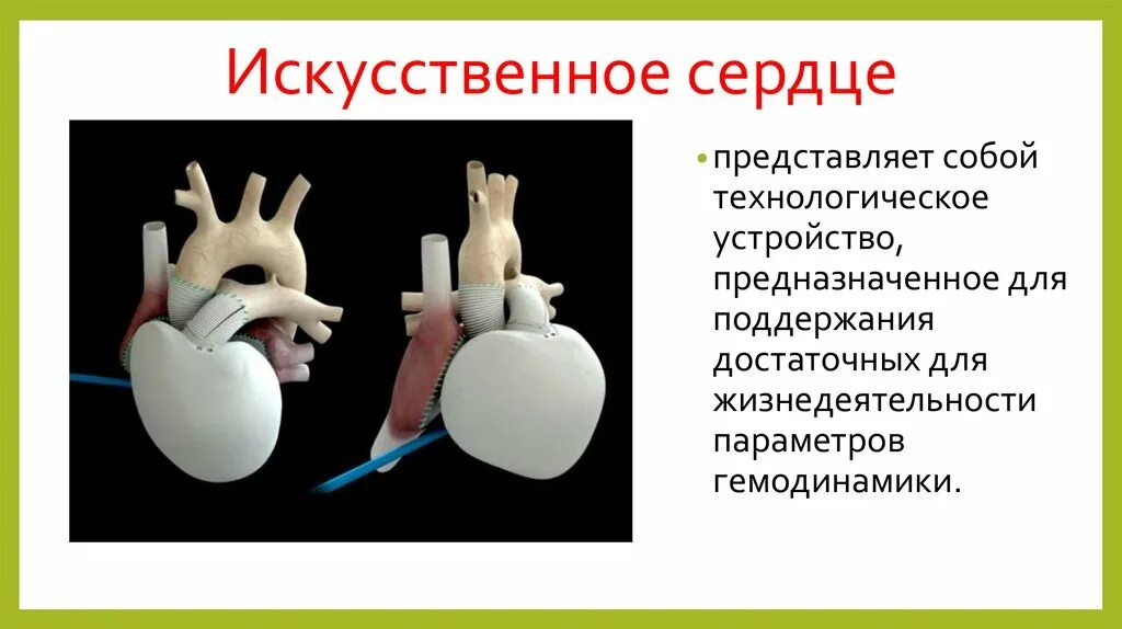 Что представляет собой искусственную