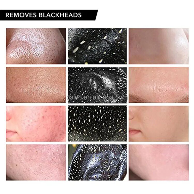 Blackhead как пользоваться. Пленка вытягивающая черные точки. Маска вытягивающая черные точки. Маска от черных точек розовая. Маска Шик от черных точек.