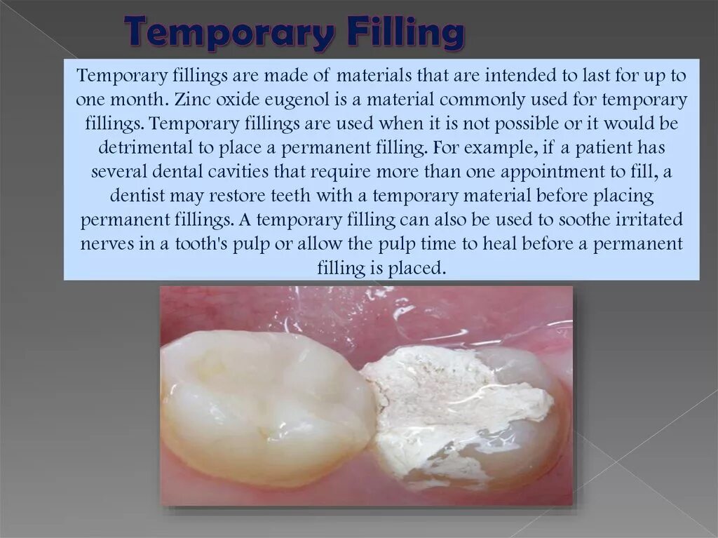 Filling material. Temporary permanent. Requirement for Dental material. Филлинг тайм эксидит перевести.