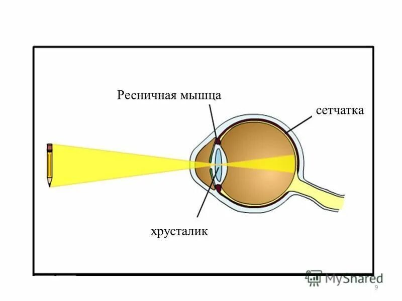 Регулирует поток света попадающего на сетчатку. Размер изображения на сетчатке. Размер проекции на сетчатке. Скорость зрения человека. Ямка диска зрительного нерва.