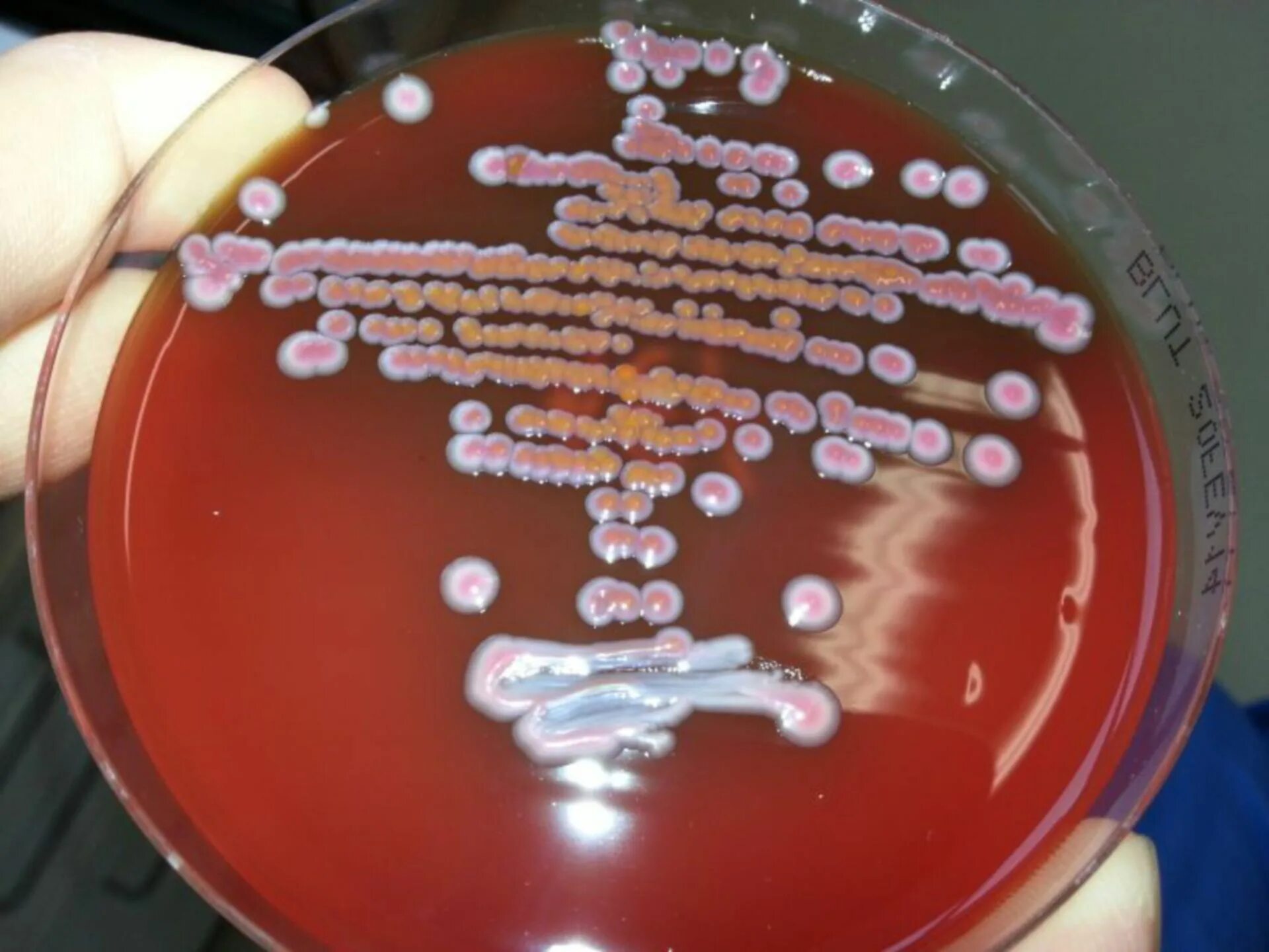 Холера питательные среды. Серрация марцесценс. Pseudomonas aeruginosa, Serratia marcescens.. Бруцеллы культивирование. Clostridium botulinum в чашке Петри.