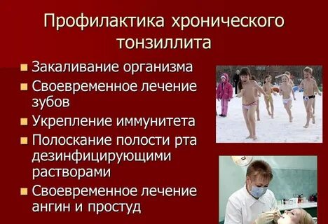 Профилактика ангины у взрослых