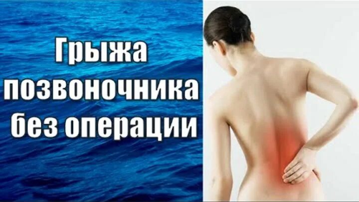 Лечение грыжи без операции. Грыжа позвоночника без операции. лечение грыжи позвоночника без операции. картавенко доктор от позвоночника. грыжа позвоночника лечение без операции видео.