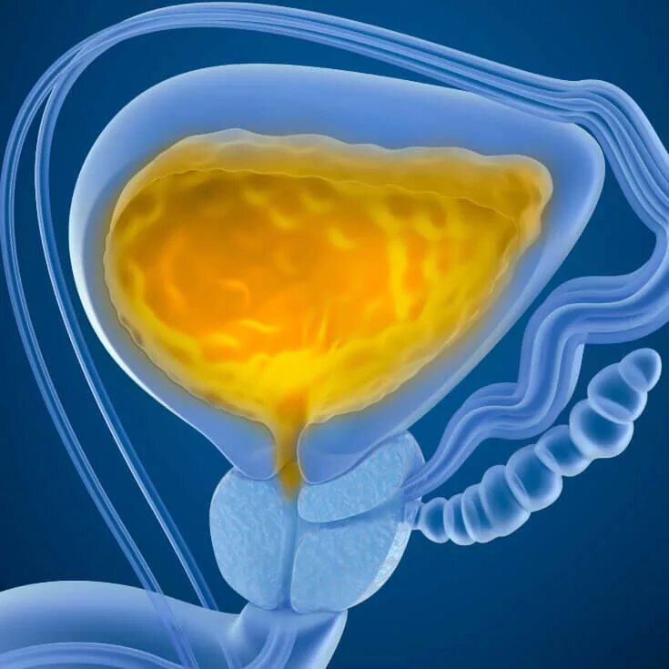 Аденома простаты недержание мочи. Острая задержка мочеиспускания. Мочеиспускание у женщин. Переполнение мочевого пузыря. Задержка мочи заболевания мочеполовой системы.
