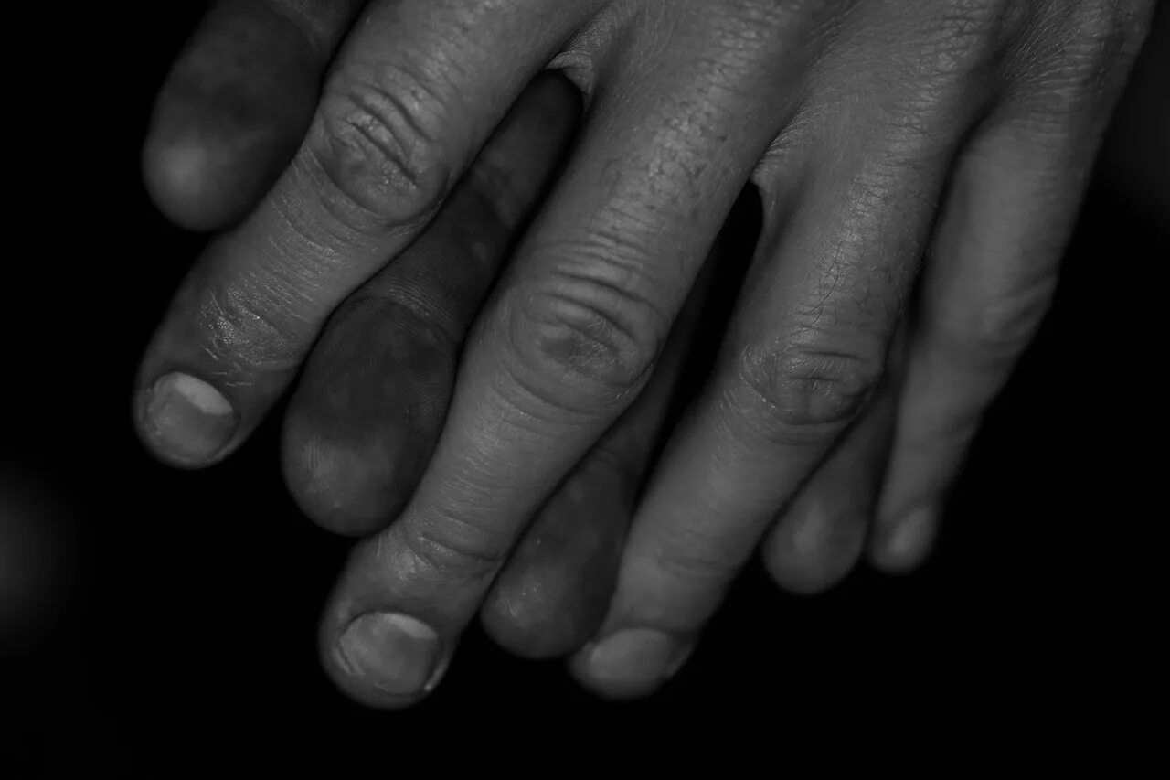 Темные пятнышки на ногтях рук. Почему темные руки. Темные полоски на ногтях рук. Темное пятнышко на ногте. Почему темные руки.