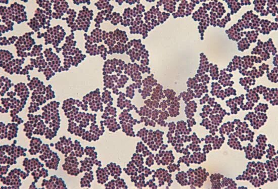 Peptostreptococcus spp