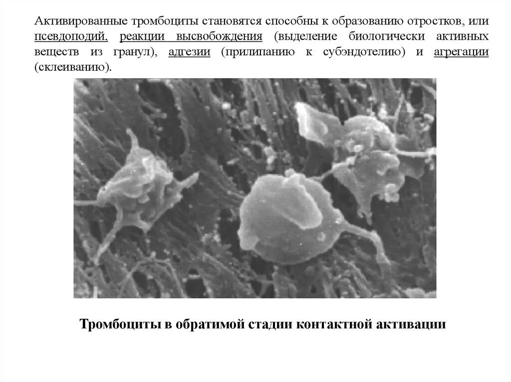 Тромбоциты микроскопия. Активированные тромбоциты. Что такое активизация тромбоцитов. Активация тромбоцитов. Способны к активному движению