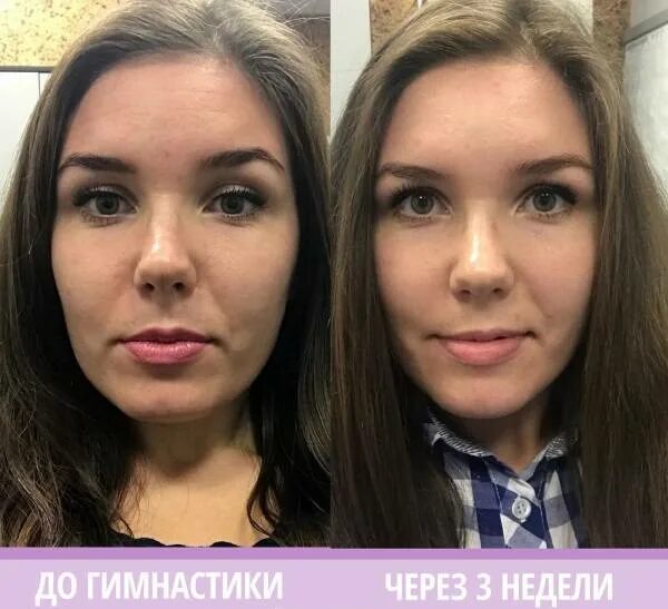 Бурдюг разоблачение до и после пластики. Фейсбилдинг анастасия бурдюг. анастасия бурдюг гимнастика для лица. анастасия бурдюг до и после. гимнастика для лица анастасии бурдюг до и после.