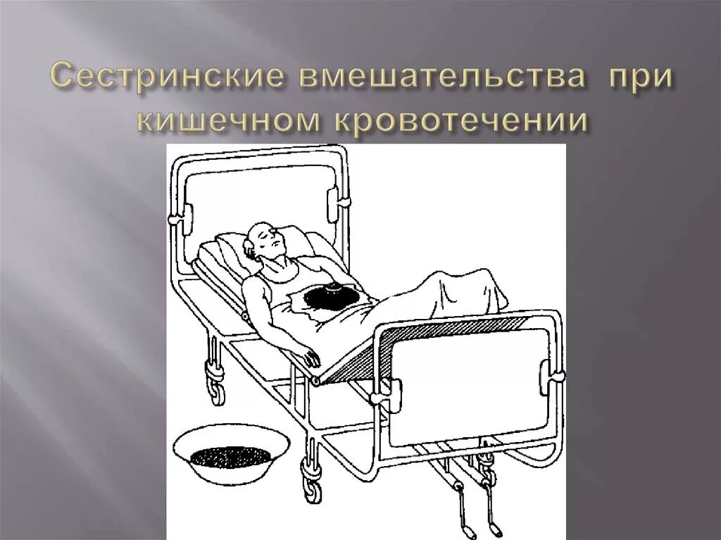 Положение больного при рвоте. Сестринский процесс при желудочном кровотечении. сестринское вмешательство при желудочном кровотечении. положение больного при желудочном кровотечении. сестринское вмешательство при кишечном кровотечении.