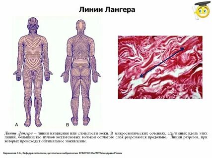 Линии лангера схемы