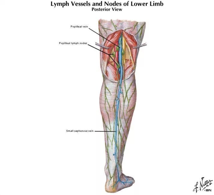 Лимфоузлы бедра нижней конечности. Регионарные лимфоузлы нижней конечности. Лимфоузел под коленом схема. Вена джиакомини анатомия. Подколенные лимфоузлы расположение.