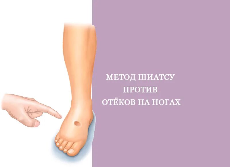Уменьшение отеков ног. Против от отеков на ногах. точки акупрессуры от отеков ног.