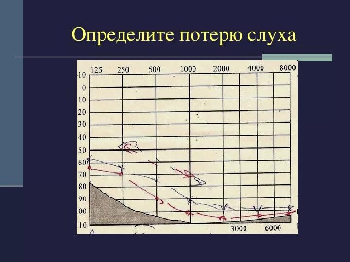 Тональная пороговая аудиограмма норма. Аудиограмма 4 степени тугоухости. Аудиограмма слуха норма. Расшифровка аудиограммы слуха норма. Аудиограмма степени