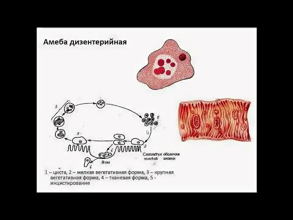 В каком организме происходит развитие дизентерийной амебы. Жизненный цикл дизентерийной амебы. Жизненный цикл дизентерийной амебы схема. Схема жизненного цикла развития дизентерийной амебы. Стадии цикла развития дизентерийной амебы.