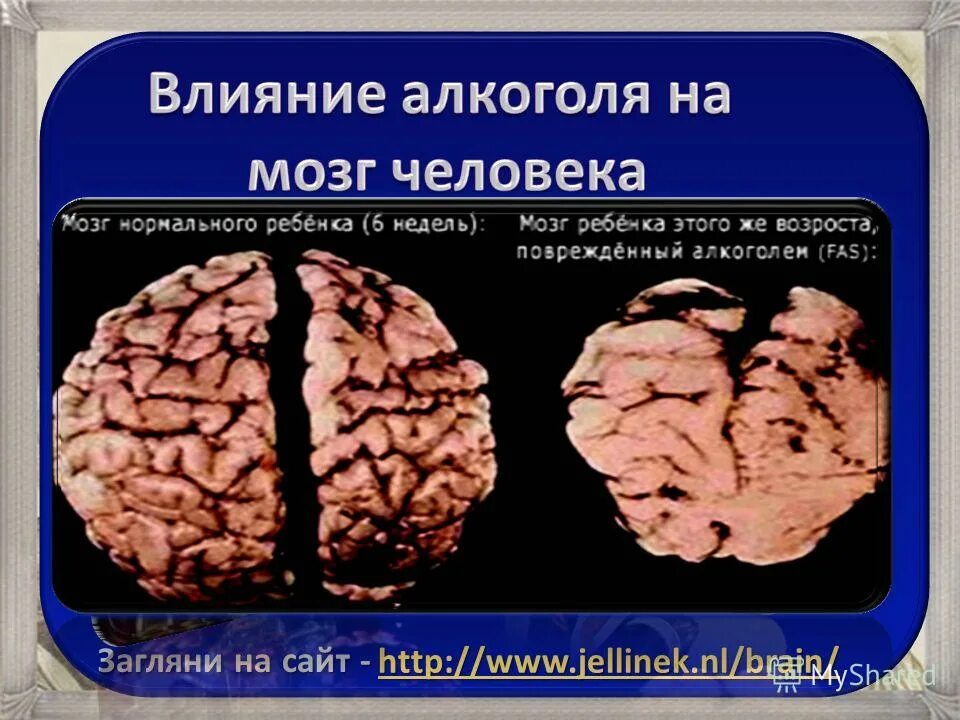 Презентации на тему мозга. Мозг Бехтерева. Изучение мозга Бехтерева. Нейрофизиология мозга Бехтерева.