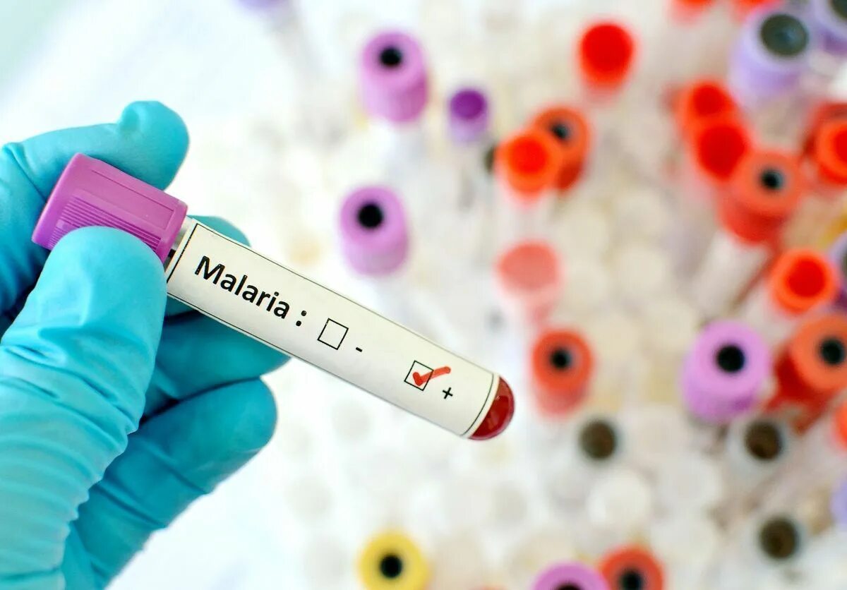 Для диагностики малярии забор крови осуществляют. Вакцина от малярии. Лабораторная диагностика малярии. Вакцина от малярии в Москве.