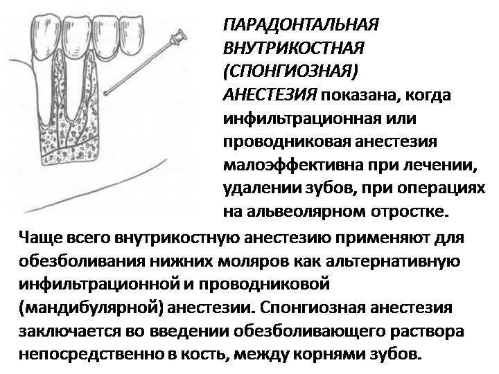 Какое зубное обезболивающее