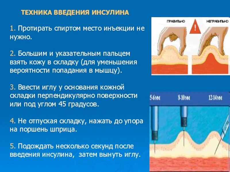 Подкожное Введение инсулина алгоритм. Ваедение ПК инсулина алгоритм. Алгоритм введения подкожной инъекции инсулина. Продемонстрируйте технику введения инсулина п/к.. Уколы вытекают почему