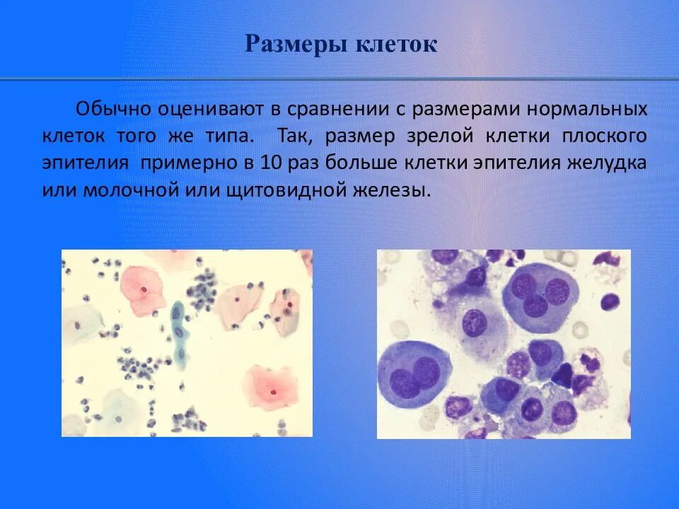 Реактивные изменения плоского эпителия в цитологии. Клетки плоского эпителия. измененные клетки. изменение клеток плоского эпителия. клетки пооского эпителия cini.