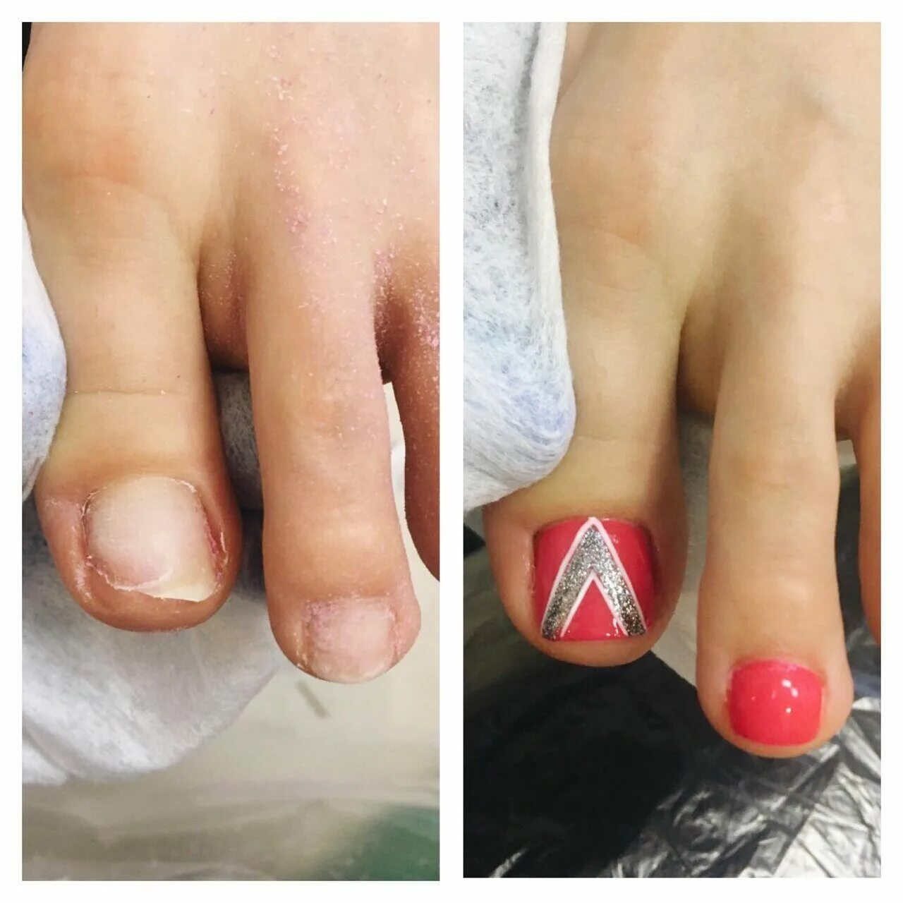 смарт педикюр от обычного. смарт педикюр от обычного. сертификат смарт педикюр. педикюр аппаратный smart. диски для педикюра.