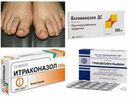 Грибок ногтей на ногах какие таблетки принимать