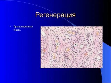 Регенерация какой ткани