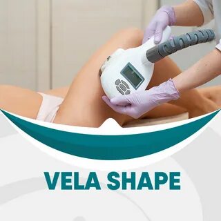Vela shape