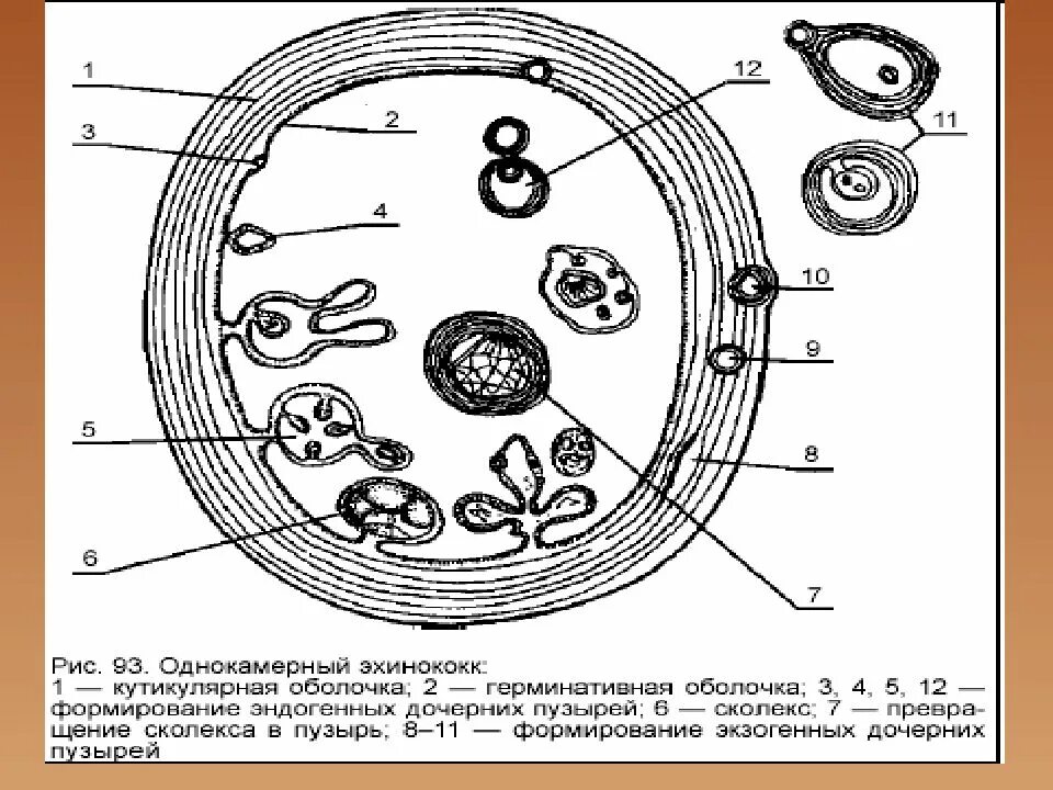 Какой цифрой на рисунке обозначена яйцо эхинококка