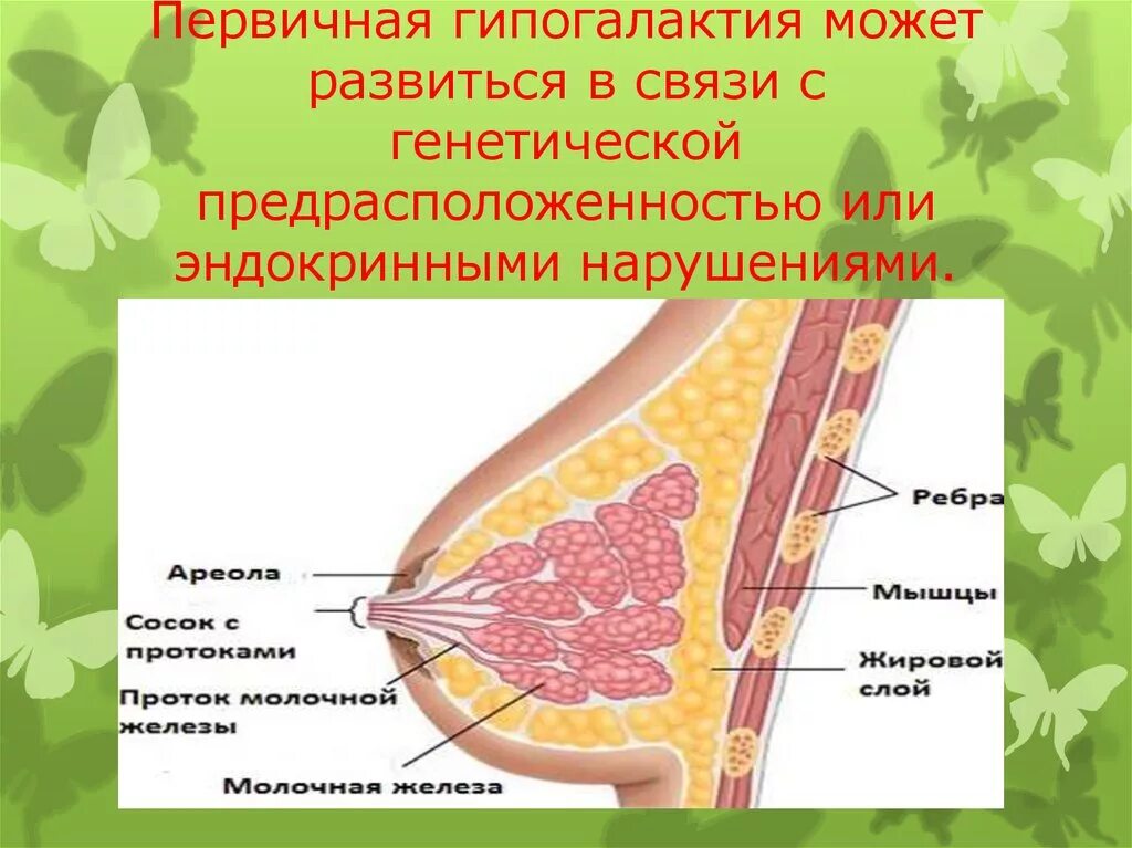 Гиполактия. Первичная гипогалактия. Гипогалактия презентация. Гипогалактия первичная и вторичная. Типы гипогалактии.