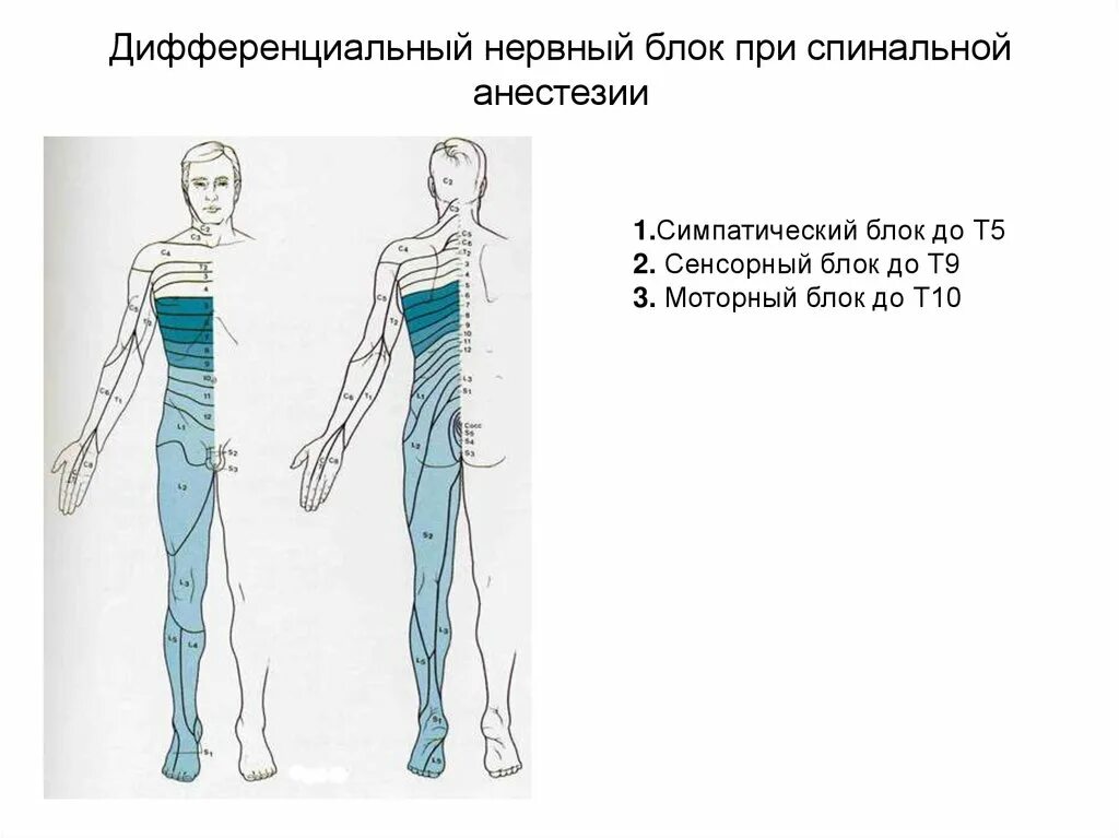 Боли в спине после спинальной анестезии. Боли в спине после спинальной анестезии