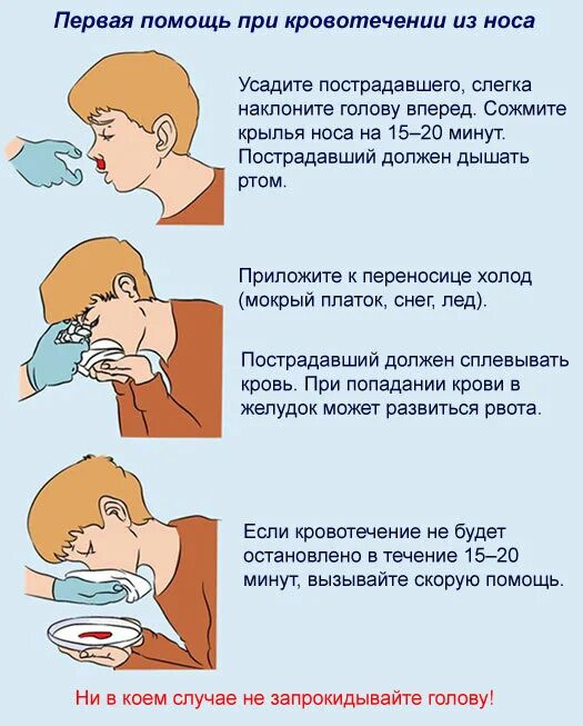 Сон доставать из носа. При носовом кровотечении холод накладывается на. при кровотечении из носа. первая помощь при носовом кровотечении. остановка кровотечения из носа.