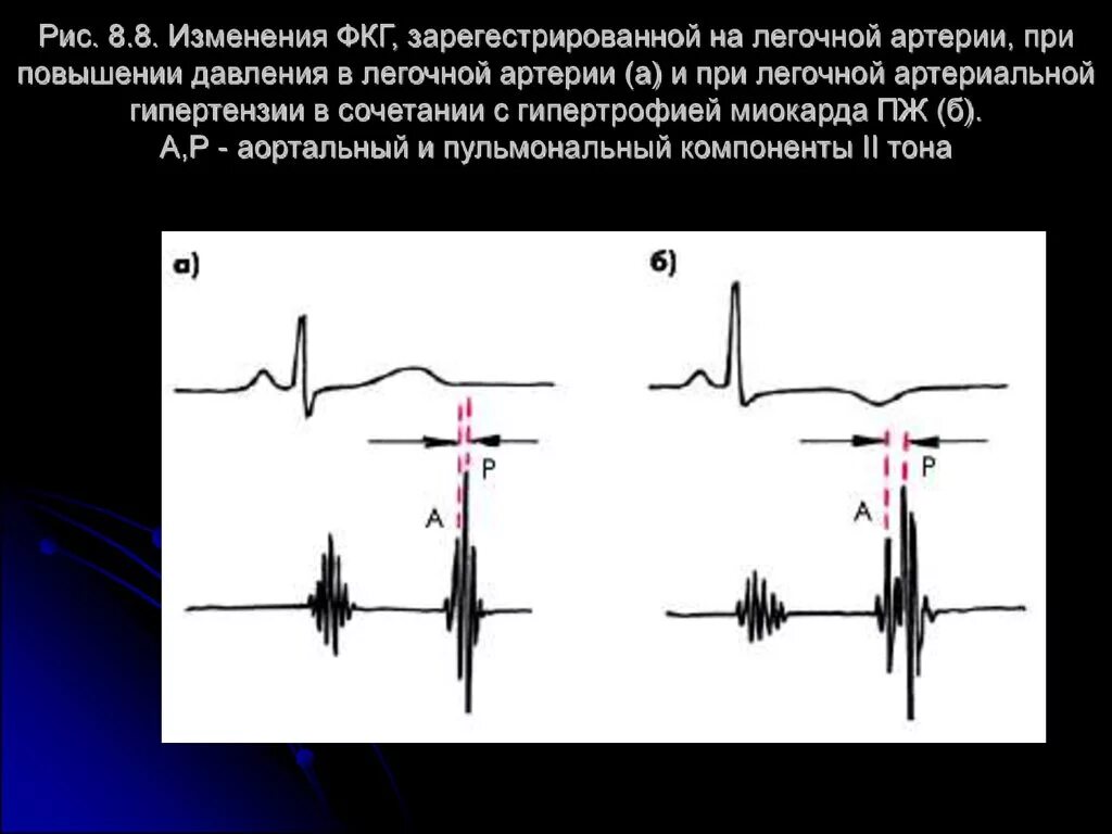 Графическое изображение фкг