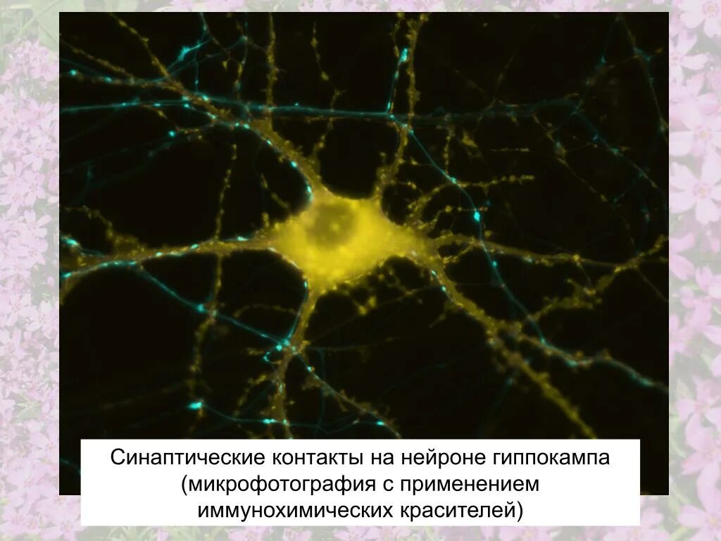 нервные клетки микрофотография. клетка нейрона под микроскопом. нейрон микрофотография. синапс микрофотография. нервные клетки микрофотография.