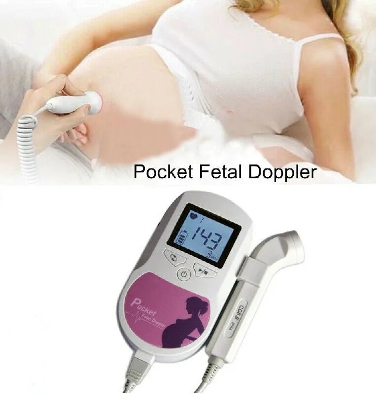 фетальный допплер бирюзовый. фетальный допплер вреден. допплер pocket fetal doppler. доплер беременной. фетальный допплер contec baby sound c1.