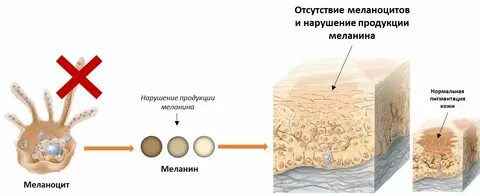 Синтез пигмента меланина