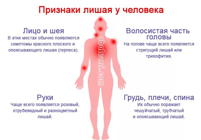 Зуд слабость температура. Как выглядит лишай у человека.