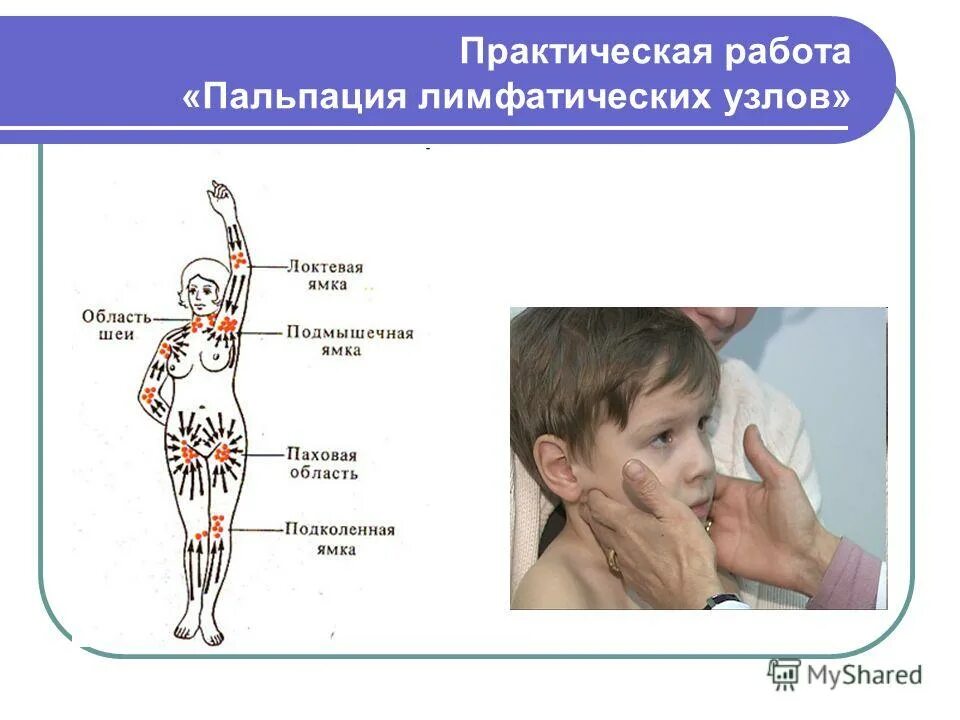 в норме пальпируются лимфатические узлы. как прощупать лимфоузлы. как прощупать лимфоузлы. пальпация лимфатических узлов рисунок. пальпация затылочных лимфатических узлов.