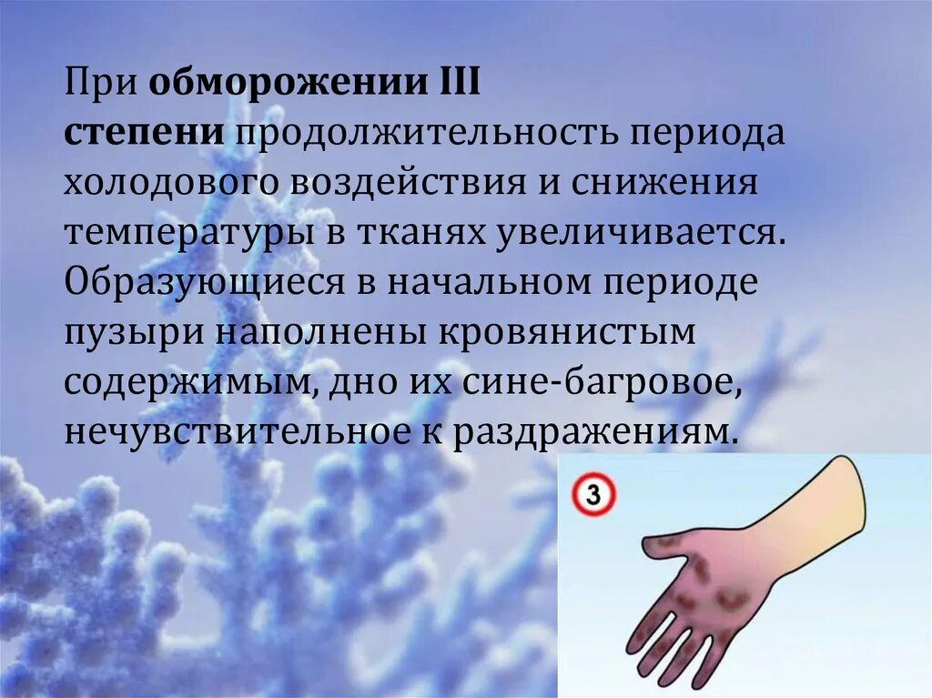Первая помощь при обморожении