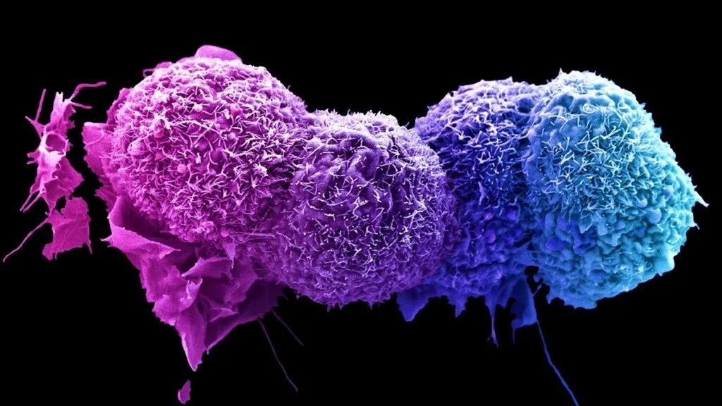 Cancer edition